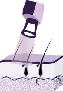 image test 1