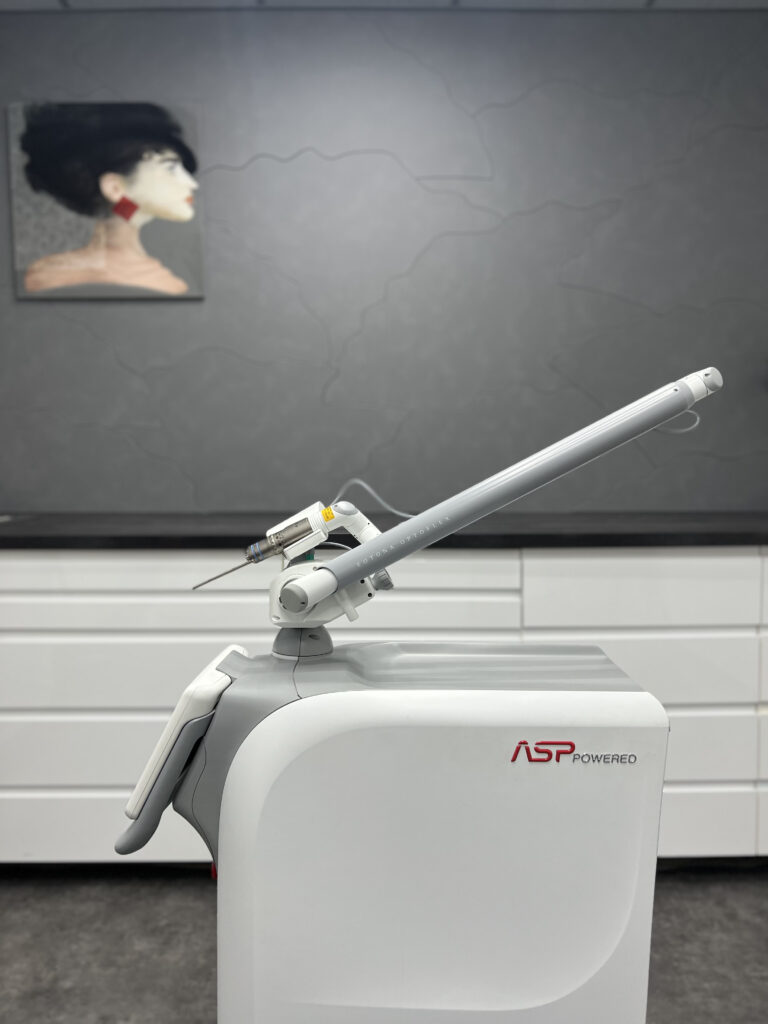 laser_detatouage_fotona_a_toulouse