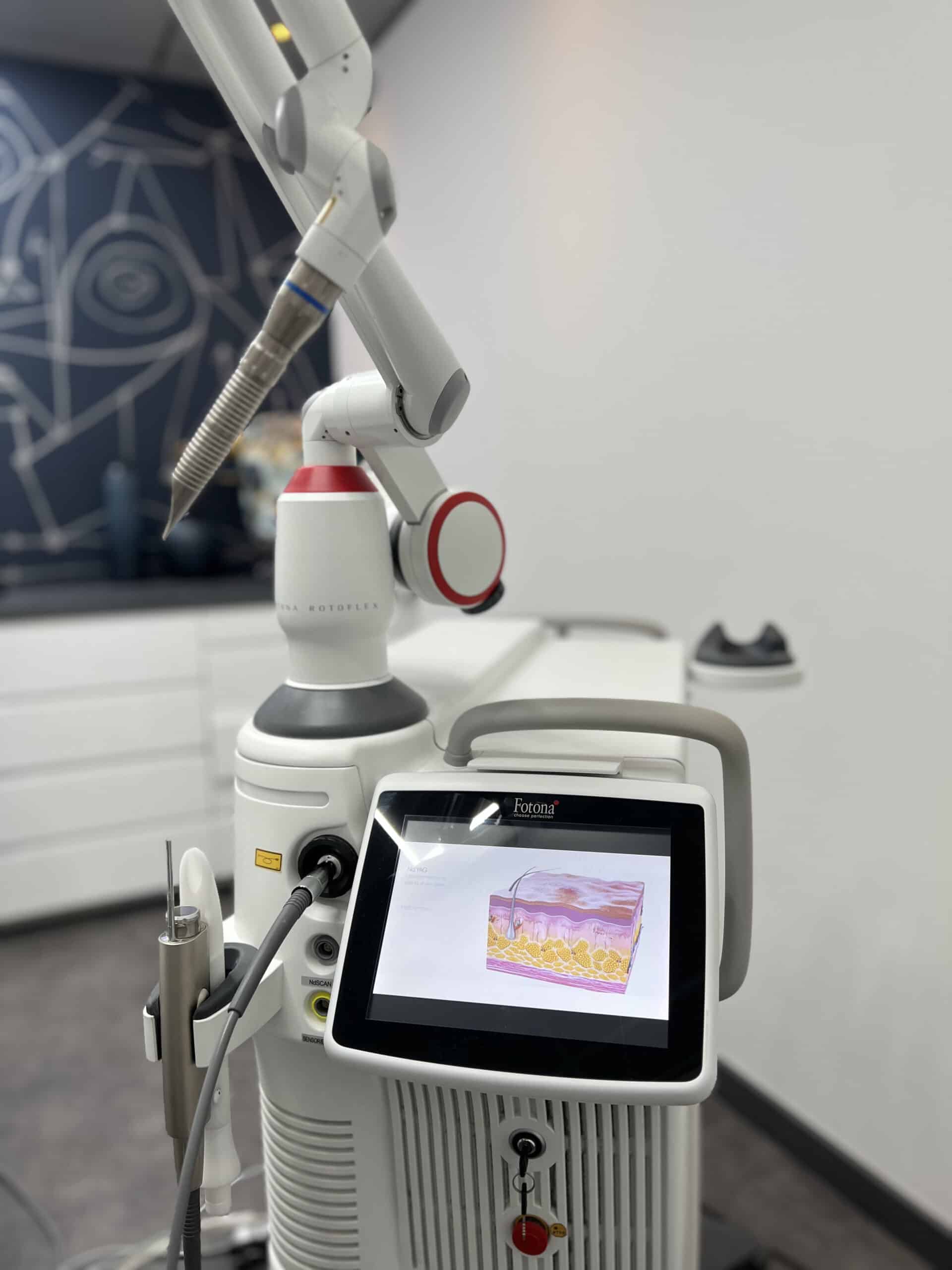 laser vasculaire fotona a toulouse